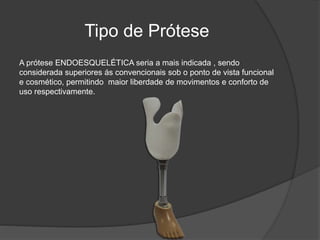 Tipo de Prótese
A prótese ENDOESQUELÉTICA seria a mais indicada , sendo
considerada superiores ás convencionais sob o ponto de vista funcional
e cosmético, permitindo maior liberdade de movimentos e conforto de
uso respectivamente.
 