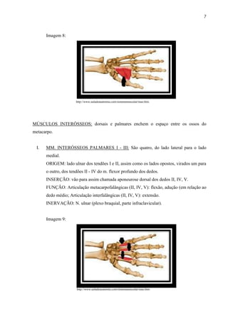 7



      Imagem 8:




                      http://www.auladeanatomia.com/sistemamuscular/mao.htm




MÚSCULOS INTERÓSSEOS: dorsais e palmares enchem o espaço entre os ossos do
metacarpo.


 I.   MM. INTERÓSSEOS PALMARES I - III: São quatro, do lado lateral para o lado
      medial.
      ORIGEM: lado ulnar dos tendões I e II, assim como os lados opostos, virados um para
      o outro, dos tendões II - IV do m. flexor profundo dos dedos.
      INSERÇÃO: vão para assim chamada aponeurose dorsal dos dedos II, IV, V.
      FUNÇÃO: Articulação metacarpofalângicas (II, IV, V): flexão, adução (em relação ao
      dedo médio; Articulação interfalângicas (II, IV, V): extensão.
      INERVAÇÃO: N. ulnar (plexo braquial, parte infraclavicular).


      Imagem 9:




                      http://www.auladeanatomia.com/sistemamuscular/mao.htm
 