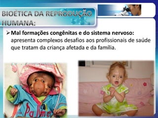 Mal formações congênitas e do sistema nervoso:
apresenta complexos desafios aos profissionais de saúde
que tratam da criança afetada e da família.
 