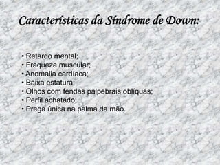 Características da Síndrome de Down: • Retardo mental; • Fraqueza muscular; • Anomalia cardíaca; • Baixa estatura; • Olhos com fendas palpebrais oblíquas; • Perfil achatado; • Prega única na palma da mão.