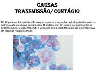 Causas
Transmissão/ Contágio
O HIV pode ser transmitido pelo sangue, esperma e secreção vaginal, pelo leite materno,
ou transfusão de sangue contaminado. O portador do HIV, mesmo sem apresentar os
sintomas da AIDS, pode transmitir o vírus, por isso, a importância do uso de preservativo
em todas as relações sexuais.
 