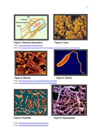 7

Figura 1- Estrutura da bactéria

Figura 2- Coco

Fonte 1: http://saude.hsw.uol.com.br/celulas1.htm
Fonte 2: http://juliasarabioifes.wordpress.com/2011/04/04/classificacao-das-bacterias-metodo-de-gram-morfologia/

Figura 3- Bacilos

Figura 4- Vibrião

Fonte 3: http://cienciahoje.uol.com.br/noticias/2013/02/ameaca-escondida/
Fonte 4: http://darwinismo.wordpress.com/2011/10/17/a-resposta-estatica/

Figura 5- Espirilos
Fonte 5: http://html.rincondelvago.com/microbiologia_2.html
Fonte 6: http://bioenciclopedia.altervista.org/spirochete.html

Figura 6- Espiroquetas

 