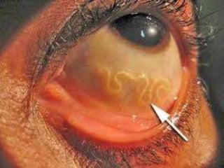 Trabalho de biologia 2