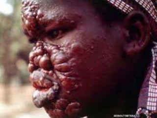 Trabalho de biologia 2