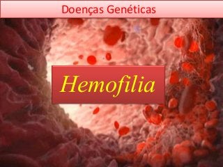 Hemofilia
Doenças Genéticas
 