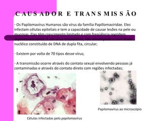 CAUSADOR E TRANSMISSÃO Os Papilomavírus Humanos são vírus da família Papillomaviridae. Eles infectam células epiteliais e tem a capacidade de causar lesões na pele ou mucosas. Elas têm crescimento limitado e com freqüência regridem espontaneamente. É um vírus icosaédrico, não envelopado e com ácido nucléico constituído de DNA de dupla fita, circular; Existem por volta de 70 tipos desse vírus; A transmissão ocorre através do contato sexual envolvendo pessoas já contaminadas e através do contato direto com regiões infectadas; Células infectadas pelo  papilomavírus Papilomavírus ao microscópio 