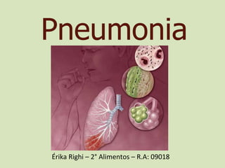 Pneumonia Érika Righi – 2° Alimentos – R.A: 09018 