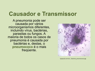 Causador e Transmissor A pneumonia pode ser causada por vários microorganismos diferentes, incluindo vírus, bactérias, parasitas ou fungos. A maioria de todos os casos de pneumonia é causada por bactérias e, destas, o  pneumococo  é o mais freqüente.   1papacaio.com.br/.../bacteria_pneumococos.jpg 