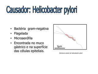 Bactéria  gram-negativa Flagelada Microaerófila Encontrada no muco gástrico e na superfície das células epiteliais. Estrutura celular da Helicobacter pylori Causador: Helicobacter pylori 