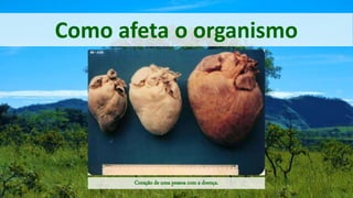 Como afeta o organismo
Coração de uma pessoa com a doença.
 