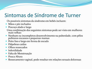 Sintomas de Síndrome de Turner
Os possíveis sintomas da síndrome em bebês incluem:
 Mãos e pés inchados
 Pescoço alado e largo
Uma combinação dos seguintes sintomas pode ser visto em mulheres
mais velhas:
 Nenhum ou incompletos desenvolvimento na puberdade, com pêlos
pubianos escassos e pequenas mamas
 Peito liso e largo em forma de escudo
 Pálpebras caídas
 Olhos ressecados
 Infertilidade
 Falta de Menstruação
 Pouca Altura
 Ressecamento vaginal, pode resultar em relações sexuais dolorosas
 