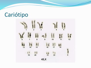 Cariótipo
 