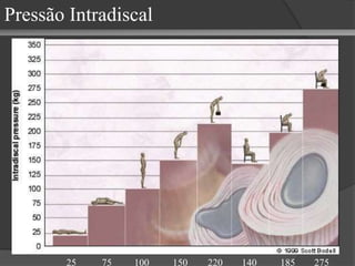 Pressão Intradiscal
25 75 100 150 220 140 185 275
 