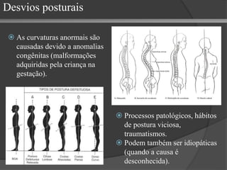 Desvios posturais
 As curvaturas anormais são
causadas devido a anomalias
congênitas (malformações
adquiridas pela criança na
gestação).
 Processos patológicos, hábitos
de postura viciosa,
traumatismos.
 Podem também ser idiopáticas
(quando a causa é
desconhecida).
 