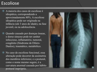 Escoliose
 A maioria dos casos de escoliose é
idiopática, correspondendo a
aproximadamente 80%. A escoliose
idiopática pode ser originada na
infância (até 3 anos de idade), na fase
juvenil, ou na adolescência.
 Quando causado por doenças ósseas,
o dorso sinuoso pode ter caráter
infeccioso, inflamatório, tumoral,
congênito (Síndrome de Ehlers-
Danlos), traumático, metabólico.
 No caso de escoliose funcional, essa
alteração pode decorrer da assimetria
dos membros inferiores; e a postural,
como o nome mesmo sugere, é a
curvatura anormal causada por hábito
postural impróprio.
 