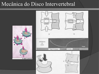 Mecânica do Disco Intervertebral
 