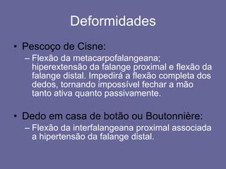 Deformidades Pescoço de Cisne: Flexão da metacarpofalangeana; hiperextensão da falange proximal e flexão da falange distal. Impedirá a flexão completa dos dedos, tornando impossível fechar a mão tanto ativa quanto passivamente. Dedo em casa de botão ou Boutonnière: Flexão da interfalangeana proximal associada a hipertensão da falange distal. 