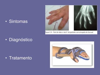 Sintomas Diagnóstico Tratamento 