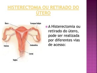 A Histerectomia ou 
retirado do útero, 
pode ser realizada 
por diferentes vias 
de acesso: 
 