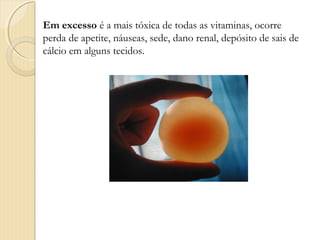 Em excesso é a mais tóxica de todas as vitaminas, ocorre
perda de apetite, náuseas, sede, dano renal, depósito de sais de
cálcio em alguns tecidos.
 