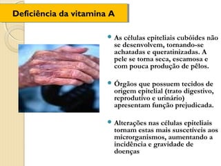 Deficiência da vitamina A
Deficiência da vitamina A

                       As células epiteliais cubóides não
                        se desenvolvem, tornando-se
                        achatadas e queratinizadas. A
                        pele se torna seca, escamosa e
                        com pouca produção de pêlos.

                       Órgãos que possuem tecidos de
                        origem epitelial (trato digestivo,
                        reprodutivo e urinário)
                        apresentam função prejudicada.

                       Alterações nas células epiteliais
                        tornam estas mais suscetíveis aos
                        microrganismos, aumentando a
                        incidência e gravidade de
                        doenças
 