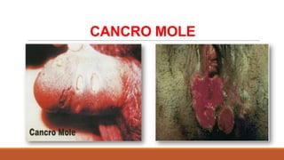 CANCRO MOLE

 
