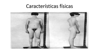 Características físicas
 