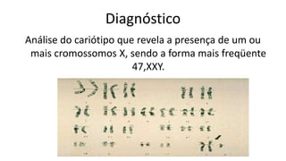 Diagnóstico
Análise do cariótipo que revela a presença de um ou
 mais cromossomos X, sendo a forma mais freqüente
                        47,XXY.
 