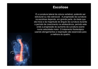Escoliose
É a curvatura lateral da coluna vertebral, podendo ser
estrutural ou não estrutural. A progressão da curvatura
na escoliose depende, em grande parte, da idade que
ela inicia e da magnitude do ângulo da curvatura durante
o período de crescimento na adolescência, período este
onde a progressão do aumento da curvatura ocorre
numa velocidade maior. O tratamento fisioterápico
usando alongamentos e respiração são essenciais para
a melhora do quadro.

 