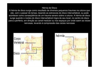Hérnia de Disco
A hérnia de disco surge como resultado de diversos pequenos traumas na coluna que
vão, com o passar do tempo, lesando as estruturas do disco intervertebral, ou pode
acontecer como conseqüência de um trauma severo sobre a coluna. A hérnia de disco
surge quando o núcleo do disco intervertebral migra de seu local, no centro do disco
para a periferia, em direção ao canal medular ou nos espaços por onde saem as raízes
nervosas, levando à compressão das raízes nervosas

 