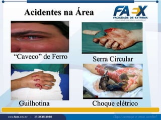 Acidentes na Área 
“Caveco” de Ferro Serra Circular 
Guilhotina Choque elétrico 
 