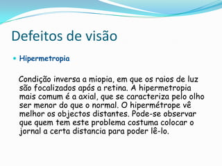 Defeitos de visão
 Hipermetropia

 Condição inversa a miopia, em que os raios de luz
 são focalizados após a retina. A hipermetropia
 mais comum é a axial, que se caracteriza pelo olho
 ser menor do que o normal. O hipermétrope vê
 melhor os objectos distantes. Pode-se observar
 que quem tem este problema costuma colocar o
 jornal a certa distancia para poder lê-lo.
 
