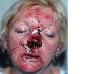 Violência Doméstica