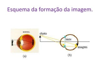 Esquema da formação da imagem.
 
