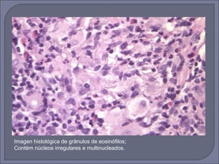Imagen histológica de grânulos de eosinófilos; 
Contém núcleos irregulares e multinucleados. 
 