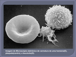 Imagem de Microscópio eletrônico de varredura de uma hemácia(E), 
plaqueta(centro), e leucócito(D). 
 