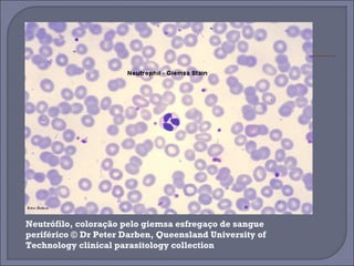 Neutrófilo, coloração pelo giemsa esfregaço de sangue 
periférico © Dr Peter Darben, Queensland University of 
Technology clinical parasitology collection 
 