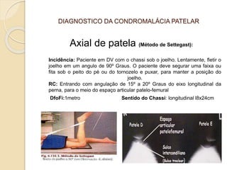 DIAGNOSTICO DA CONDROMALÁCIA PATELAR
Axial de patela (Método de Settegast):
Incidência: Paciente em DV com o chassi sob o joelho. Lentamente, fletir o
joelho em um angulo de 90º Graus. O paciente deve segurar uma faixa ou
fita sob o peito do pé ou do tornozelo e puxar, para manter a posição do
joelho.
RC: Entrando com angulação de 15º a 20º Graus do eixo longitudinal da
perna, para o meio do espaço articular patelo-femural
DfoFi:1metro Sentido do Chassi: longitudinal l8x24cm
 