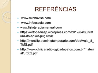 REFERÊNCIAS
 www.minhavisa.com
 www.infoescola.com
 www.fisioterapiamanual.com
 https://ortopediasp.wordpress.com/2012/04/30/frat
ura-do-boxer-pugilista/
 http://montillo.dominiotemporario.com/doc/Aula_8_
TMS.pdf
 http://www.clinicaradiologicadepatos.com.br/materi
al/urg02.pdf
 