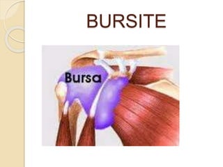 BURSITE
 