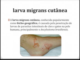 larva migrans cutânea
0 A larva migrans cutânea, conhecida popularmente
como bicho-geográfico, é causada pela penetração de
larvas de parasitas intestinais de cães e gatos na pele
humana, principalmente o Ancylostoma brasiliensis.
 