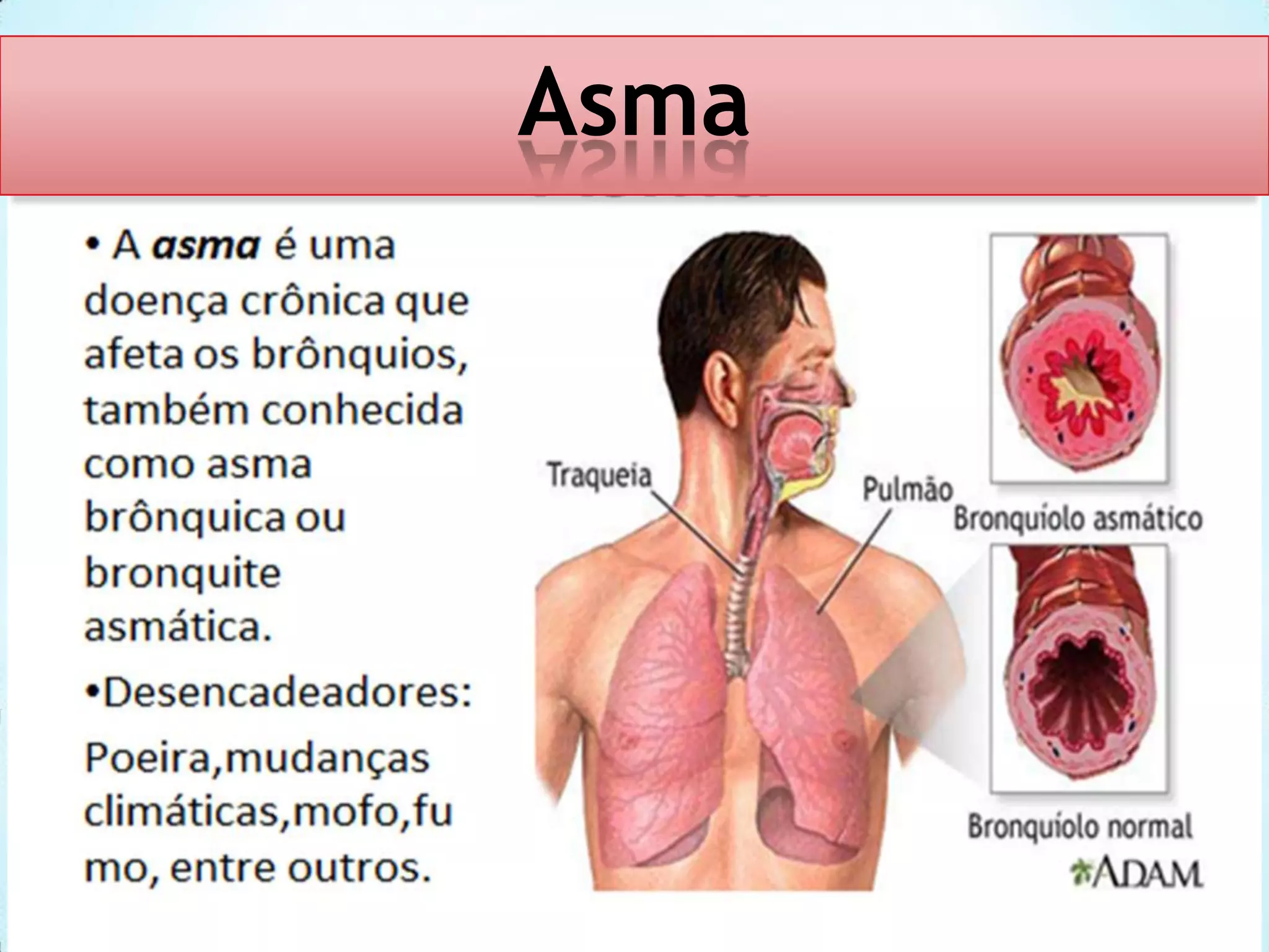 Asma

 