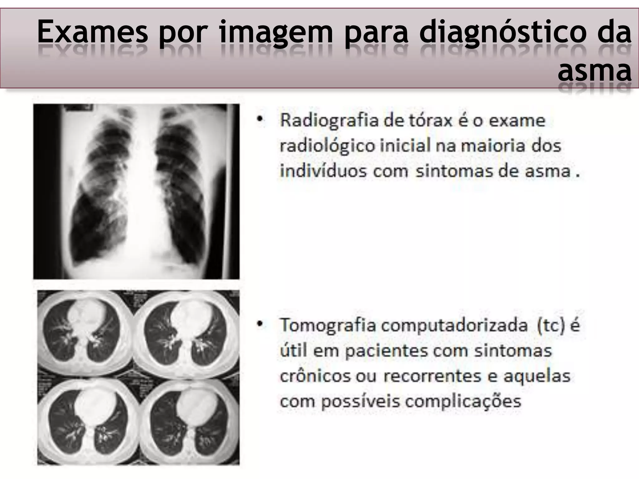 Exames por imagem para diagnóstico da
asma

 