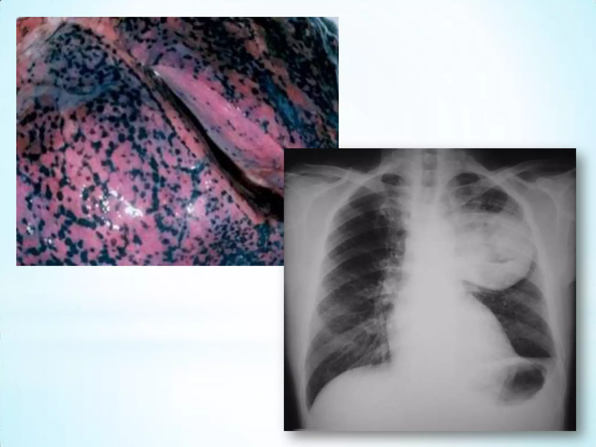 Doenças Cardiovasculares