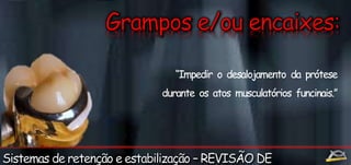 “Impedir o desalojamento da prótese 
durante os atos musculatórios funcinais.” 
 