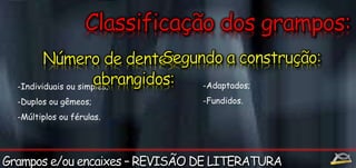 -Individuais ou simples; 
-Duplos ou gêmeos; 
-Múltiplos ou férulas. 
-Adaptados; 
-Fundidos. 
 