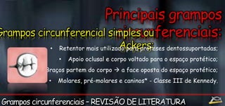 • Retentor mais utilizado para próteses dentossuportadas; 
• Apoio oclusal e corpo voltado para o espaço protético; 
• Braços partem do corpo  a face oposta do espaço protético; 
• Molares, pré-molares e caninos* - Classe III de Kennedy. 
 