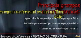 • Apoio oclusal e corpo adjacentes ao espaço protético; 
• Indicados para Molares posterior ao espaço protético; 
• Classe III ou modificação Classe II. 
 