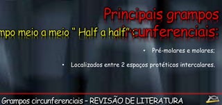 • Pré-molares e molares; 
• Localizados entre 2 espaços protéticos intercalares. 
 