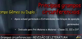 • Apoio oclusal germinado x Extremidades dos braços de oposição 
germinados; 
• Indicado para Pré-Molares e Molares – Classe II, III e IV*. 
 